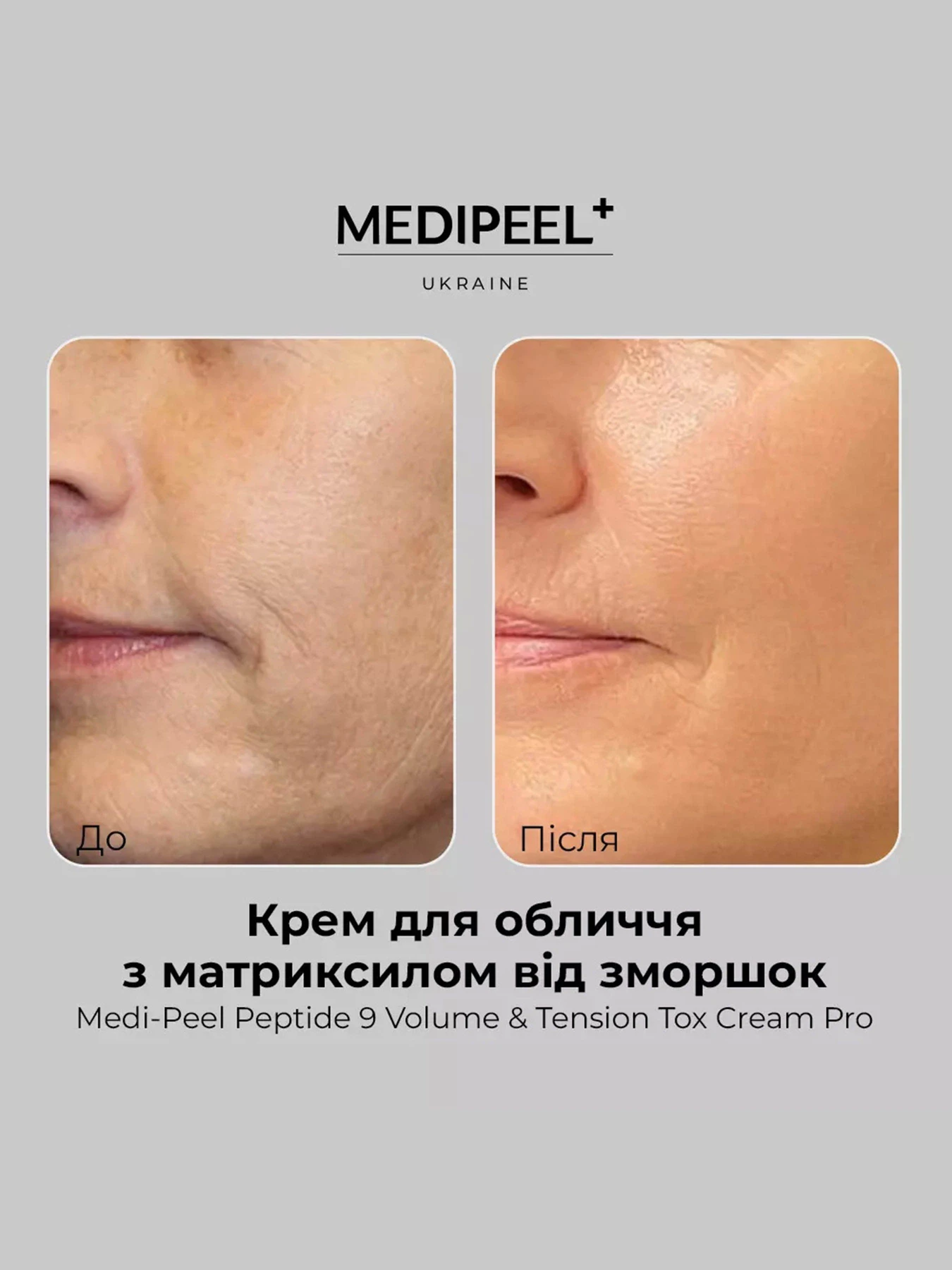 Крем з ліфтинг ефектом Medi-Peel модель 8809941820430 Крем з ліфтинг ефектом Medi-Peel модель 8809941820430 Фото