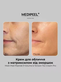 Крем з ліфтинг ефектом Medi-Peel модель 8809941820430 Фото