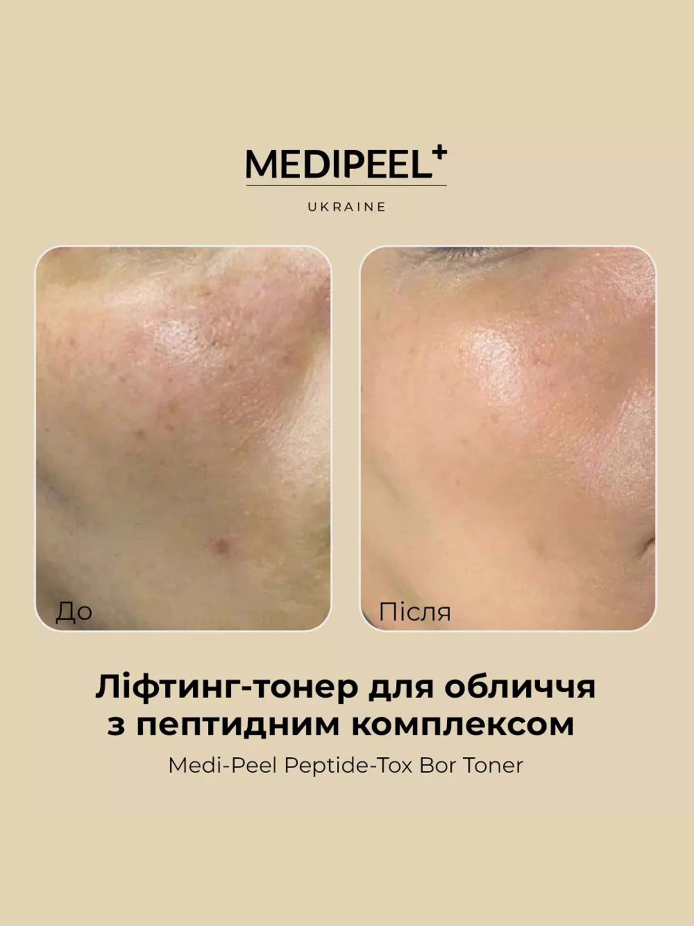 Тонер проти зморшок Medi-Peel модель 8809409348308 Тонер проти зморшок Medi-Peel модель 8809409348308 Фото