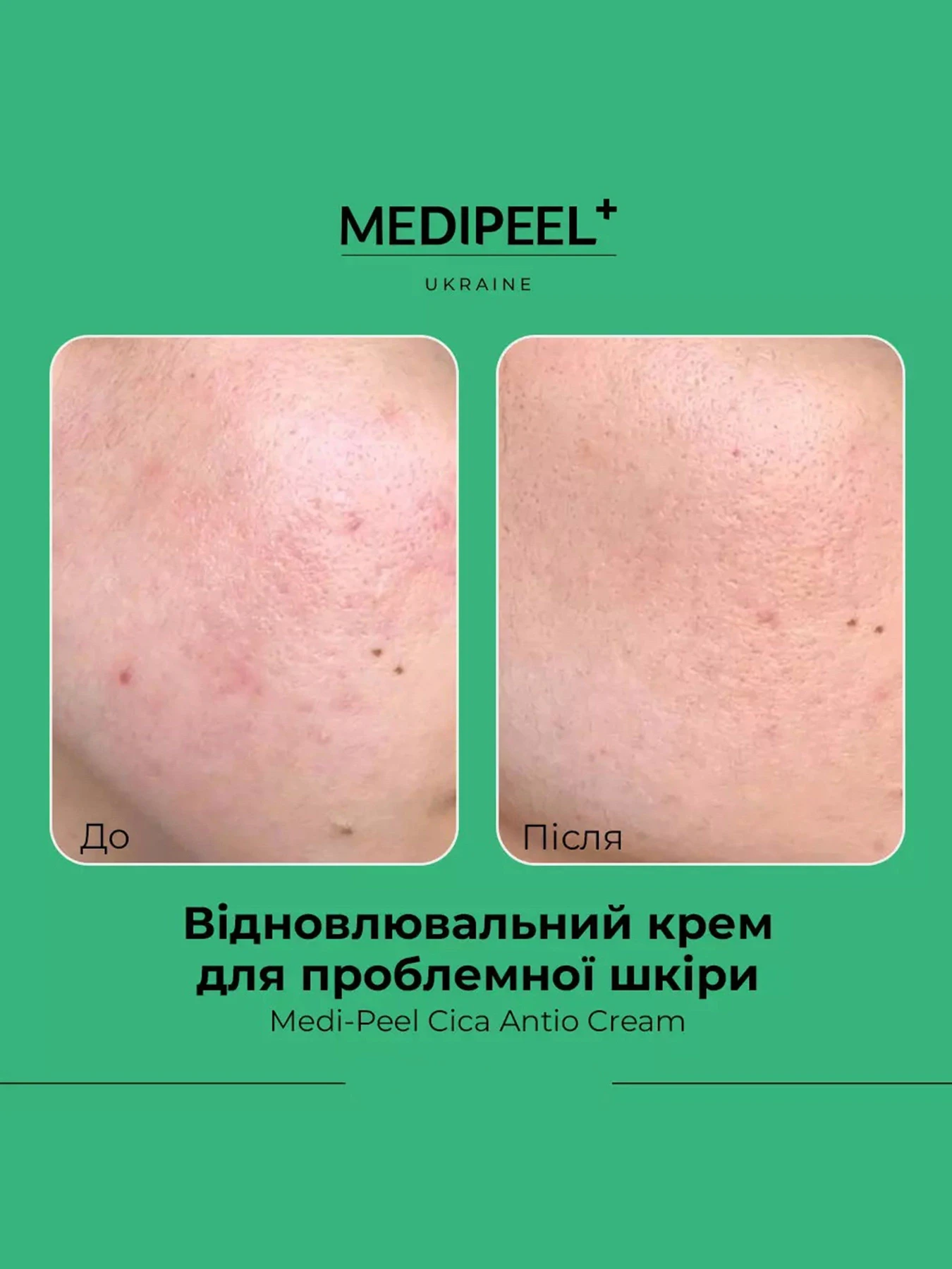 Крем відновлювальний Medi-Peel модель 8809409343549 Крем відновлювальний Medi-Peel модель 8809409343549 Фото