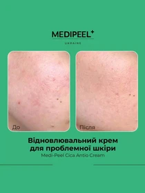 Крем відновлювальний Medi-Peel модель 8809409343549 Фото