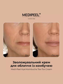 Крем зволожувальний з комбучею Medi-Peel модель 8809409346489 Фото