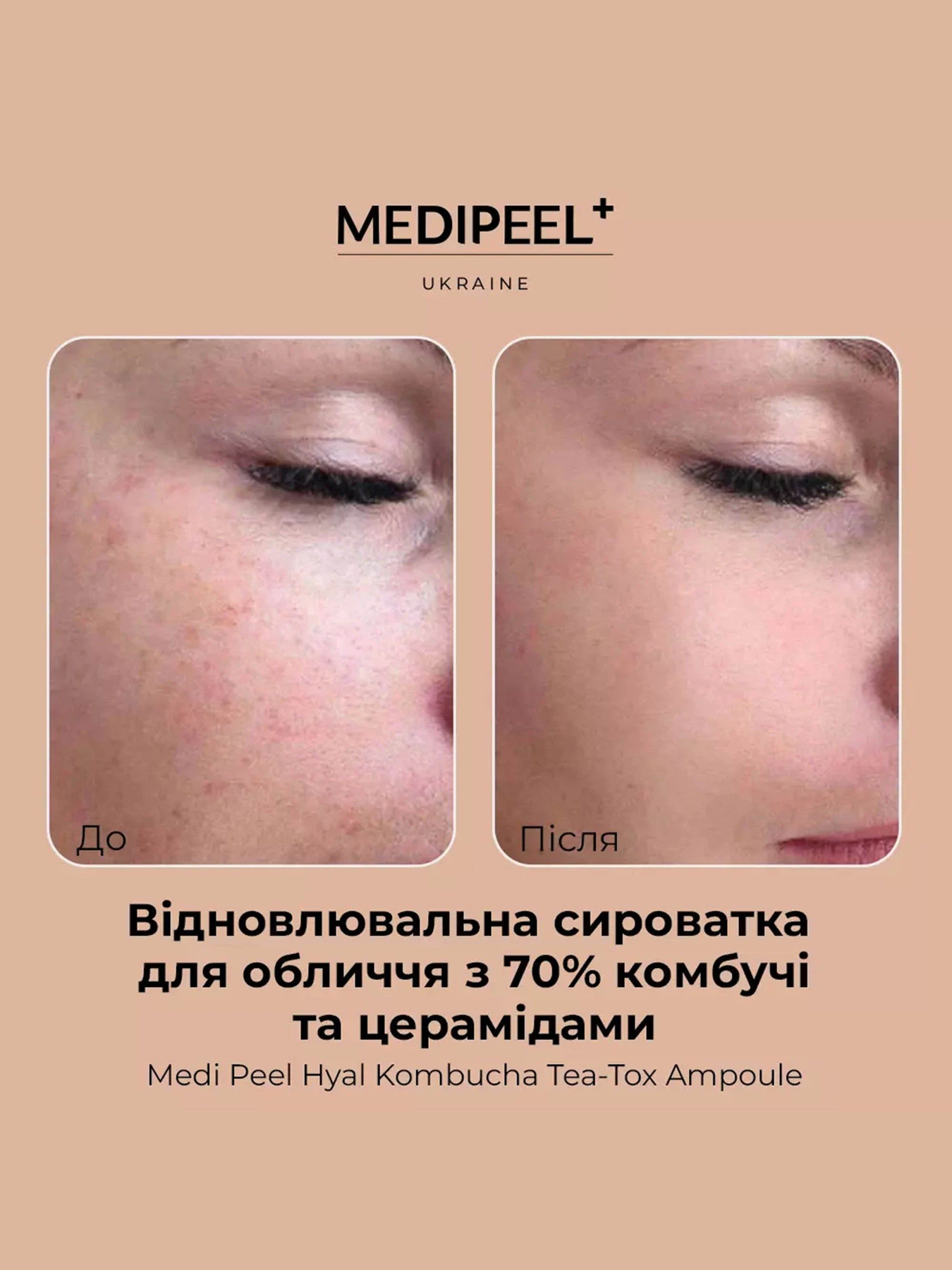 Сыворотка увлажняющая Medi-Peel модель 8809409346458 Сыворотка увлажняющая Medi-Peel модель 8809409346458 Фото