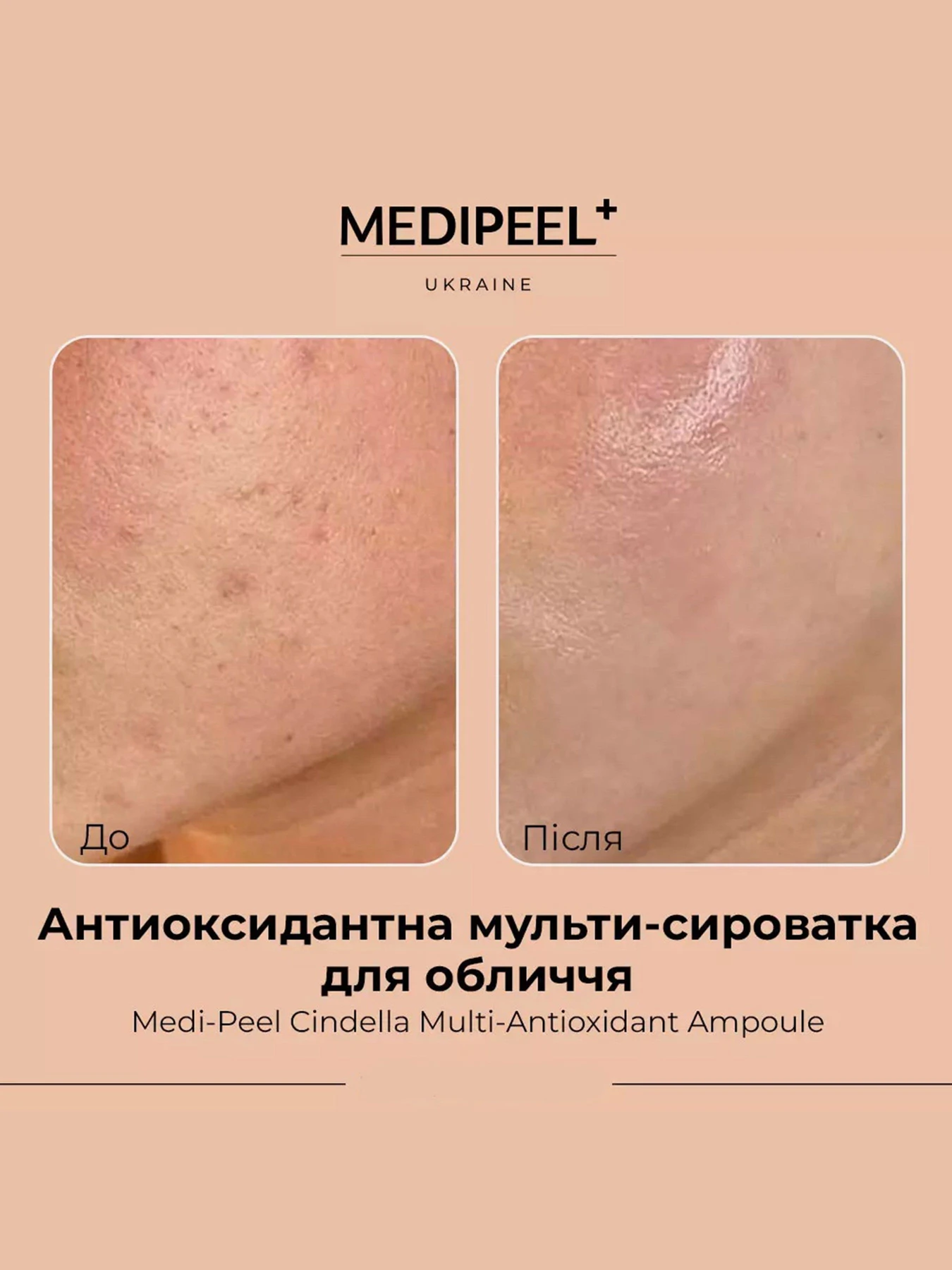Сироватка антиоксидантна Medi-Peel модель 8809409345024 Сироватка антиоксидантна Medi-Peel модель 8809409345024 Фото