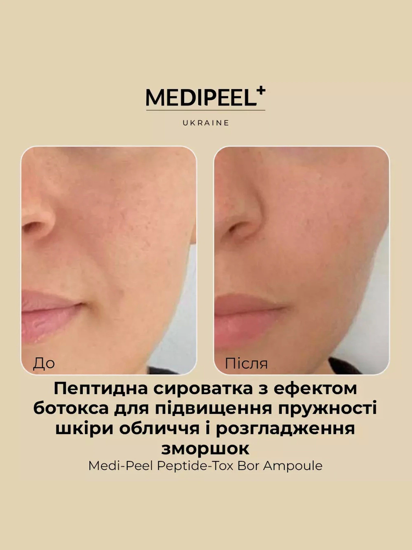 Сироватка проти зморшок Medi-Peel модель 8809409341705 Сироватка проти зморшок Medi-Peel модель 8809409341705 Фото