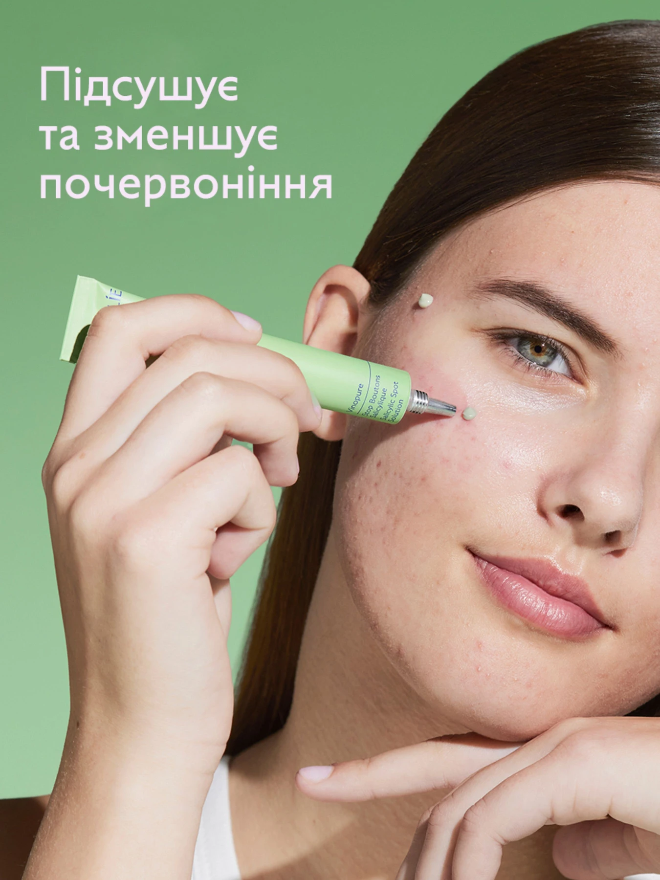 Vinopure SOS Засіб косметичний із саліциловою кислотою CAUDALIE модель 502 Vinopure SOS Засіб косметичний із саліциловою кислотою CAUDALIE модель 502 Фото
